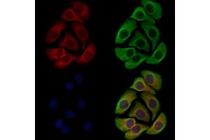 ABIN7094662 and ABIN7098713 staining Hela cells by IF/ICC.