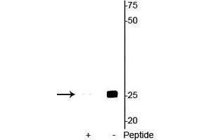 Western blot of mouse heart lysate showing specific immunolabeling of the ~25 kDa cardiac troponin I protein phosphorylated at Ser23/24 in the second lane (-). (TNNI3 抗体  (pSer23, pSer24))