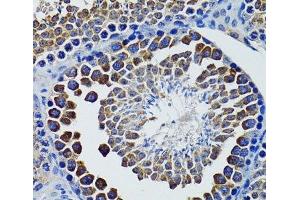 Immunohistochemistry of paraffin-embedded Rat testis using HEXA Polyclonal Antibody at dilution of 1:100 (40x lens). (Hexosaminidase A 抗体)