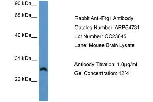 WB Suggested Anti-Frg1  Antibody Titration: 0. (FRG1 抗体  (Middle Region))