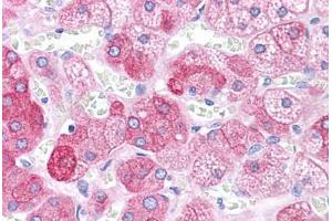 Human Adrenal: Formalin-Fixed, Paraffin-Embedded (FFPE) (BACE1 抗体  (AA 72-121))