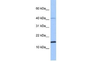 SPAG11B antibody used at 1 ug/ml to detect target protein. (SPAG11B 抗体  (N-Term))