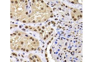 Immunohistochemistry of paraffin-embedded Human kidney using HIRIP3 Polyclonal Antibody at dilution of 1:100 (40x lens).