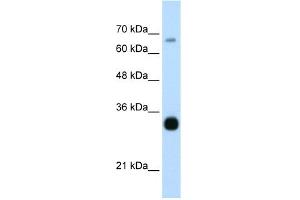 WB Suggested Anti-THOC3 Antibody Titration:  0. (THO Complex 3 抗体  (Middle Region))