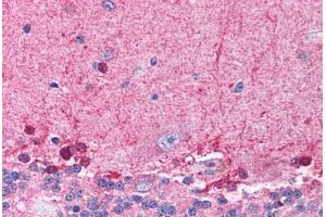 Human Brain, Cerebellum (formalin-fixed, paraffin-embedded) stained with HDAC8 antibody ABIN214773 at 5 ug/ml followed by biotinylated goat anti-rabbit IgG secondary antibody ABIN481713, alkaline phosphatase-streptavidin and chromogen. (HDAC8 抗体  (C-Term))