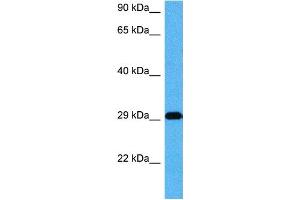 Host:  Mouse  Target Name:  CDX2  Sample Tissue:  Mouse Skeletal Muscle  Antibody Dilution:  1ug/ml (CDX2 抗体  (Middle Region))
