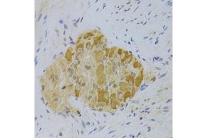 Immunohistochemistry of paraffin-embedded human rectum using PA2G4 Antibody (ABIN5973112) at dilution of 1/100 (40x lens). (PA2G4 抗体)