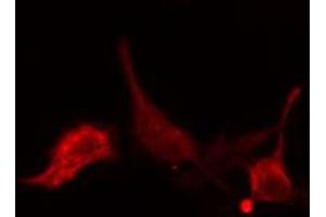 ABIN6274769 staining LOVO cells by IF/ICC. (RPL15 抗体  (C-Term))