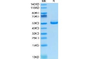 TIGIT Protein (AA 22-141) (Fc Tag)