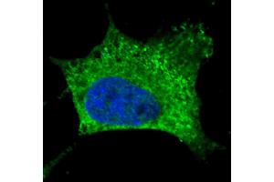 Fluorescent confocal image of SY5Y cells stained with NGFR antibody SY5Y cells were fixed with 4 % PFA (20 min), permeabilized with Triton X-100 (0. (NGFR 抗体)