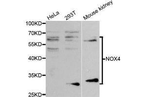 Western blot analysis of extracts of various cell lines, using NOX4 antibody. (NADPH Oxidase 4 抗体)