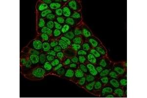 Immunofluorescence staining of PFA-fixed MCF-7 cells with MSH6 Mouse Monoclonal Antibody (MSH6/3086) followed by goat anti-mouse IgG-CF488 (green). (MSH6 抗体  (AA 374-540))