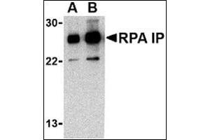 Western blot analysis of RPA Interacting Protein in Jurkat cell lysate with this product at (A) 0. (RPAIN 抗体  (C-Term))