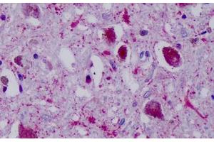 Anti-PPYR1 antibody IHC staining of human brain, substania nigra. (NPY4R 抗体  (Cytoplasmic Domain))