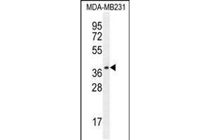 Western blot analysis in MDA-MB231 cell line lysates (35ug/lane). (PRSS3 抗体  (N-Term))