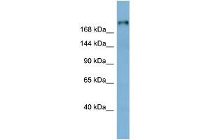 WB Suggested Anti-LAMB1 Antibody Titration:  0. (Laminin beta 1 抗体  (Middle Region))
