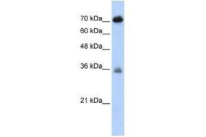 WB Suggested Anti-NKRF Antibody Titration:  0.