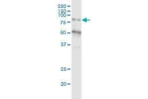 ZNF14 monoclonal antibody (M01), clone 1D8. (ZFP14 抗体  (AA 70-161))