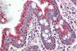 ABIN1590031 (5µg/ml) staining of paraffin embedded Human Small Intestine. (SLAMF8 抗体  (Internal Region))