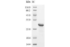Secreted phosphoprotein 1 (SPP1) (AA 17-168) protein (His tag)