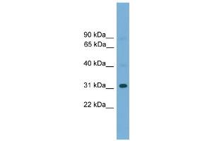WB Suggested Anti-Gm5864 Antibody Titration:  0. (Gm5864 抗体  (Middle Region))