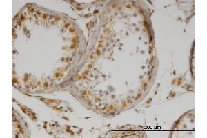 Immunoperoxidase of monoclonal antibody to IL13 on formalin-fixed paraffin-embedded human testis. (IL-13 抗体)