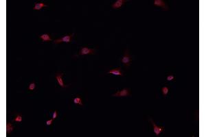 ABIN6266520 staining HeLa  cells by IF/ICC. (Cullin 1 抗体)