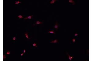ABIN6266520 staining HeLa  cells by IF/ICC. (Cullin 1 抗体)