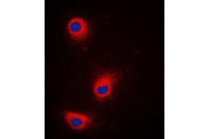 Immunofluorescent analysis of TRP2 staining in A375 cells. (DCT 抗体  (Center))