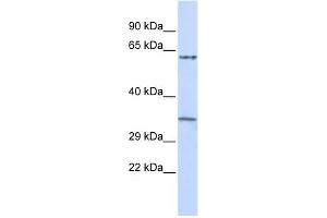 WB Suggested Anti-TRIM8 Antibody Titration:  0. (TRIM8 抗体  (Middle Region))