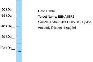 Host: Rabbit Target Name: EBNA1BP2 Sample Type: COLO205 Whole Cell lysates Antibody Dilution: 1. (EBNA1BP2 抗体  (Middle Region))