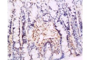 Formalin-fixed and paraffin embedded rat colon tissue labeled with Anti-P-selectin Polyclonal Antibody , Unconjugated at 1:200, followed by conjugation to the secondary antibody and DAB staining (P-Selectin 抗体  (AA 701-768))