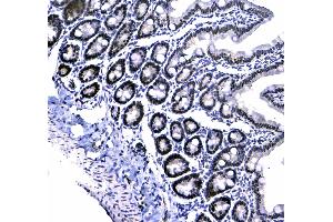IHC analysis of HP1 gamma using anti-HP1 gamma antibody . (CBX3 抗体  (AA 2-183))
