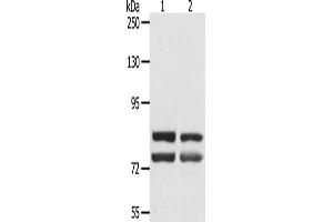 Gel: 8 % SDS-PAGE, Lysate: 40 μg, Lane 1-2: SKOV3 cells, hela cells, Primary antibody: ABIN7129182(DDX4 Antibody) at dilution 1/300, Secondary antibody: Goat anti rabbit IgG at 1/8000 dilution, Exposure time: 45 seconds (DDX4 抗体)