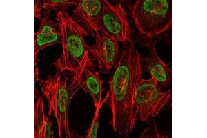 Immunofluorescence analysis of NIH/3T3 cells using PSIP1 mouse mAb (green). (PSIP1 抗体)