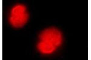 Immunofluorescent analysis of CaMK4 staining in Jurkat cells. (CAMK4 抗体)