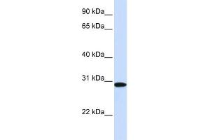 WB Suggested Anti-MTHFD2 Antibody Titration:  0. (MTHFD2 抗体  (N-Term))