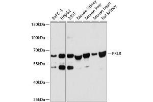 Western blot analysis of extracts of various cell lines, using PKLR antibody (ABIN6128469, ABIN6145710, ABIN6145712 and ABIN6215656) at 1:3000 dilution. (PKLR 抗体  (AA 446-556))