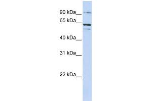 WB Suggested Anti-ABCE1 Antibody Titration:  0. (ABCE1 抗体  (C-Term))