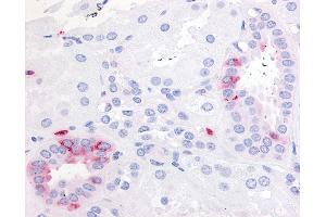 Immunohistochemistry (IHC) image for anti-Prostaglandin E Receptor 2 (Subtype EP2), 53kDa (PTGER2) (Extracellular Domain) antibody (ABIN213469)