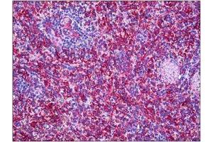 Human Spleen: Formalin-Fixed, Paraffin-Embedded (FFPE)