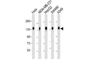 All lanes : Anti-C Antibody (C-term) at 1:2000 dilution Lane 1: Hela whole cell lysate Lane 2: MDA-MB-231 whole cell lysate Lane 3: HepG2 whole cell lysate Lane 4: S whole cell lysate Lane 5: A549 whole cell lysate Lysates/proteins at 20 μg per lane.