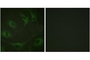 Immunofluorescence (IF) image for anti-Cas-Br-M (Murine) Ecotropic Retroviral Transforming Sequence (CBL) (AA 740-789), (pTyr774) antibody (ABIN1531306)