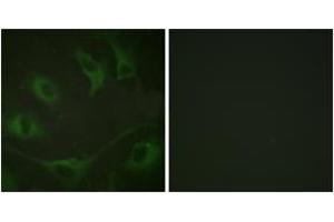 Immunofluorescence analysis of A549 cells, using CBL (Phospho-Tyr774) Antibody.