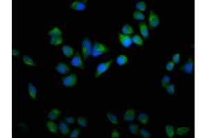Immunofluorescence staining of Hela cells with ABIN7164629 at 1:100, counter-stained with DAPI. (USP9X 抗体  (C-Term))