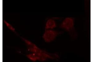 ABIN6266445 staining Hela by IF/ICC. (CAPG 抗体  (Internal Region))