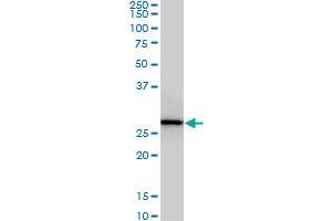 CNOT7 monoclonal antibody (M01), clone 2F6. (CNOT7 抗体  (AA 1-285))