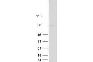 Western Blotting (WB) image for Homeobox Containing 1 (HMBOX1) (Transcript Variant 1) protein (Myc-DYKDDDDK Tag) (ABIN2722845)