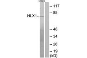 Western blot analysis of extracts from COLO205 cells, using HLX1 Antibody. (HLX 抗体  (AA 321-370))