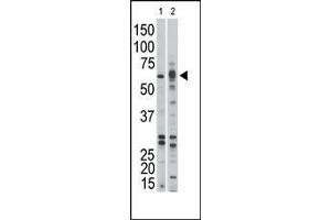Western Blotting (WB) image for anti-Activin A Receptor, Type IB (ACVR1B) (AA 134-164) antibody (ABIN392232)